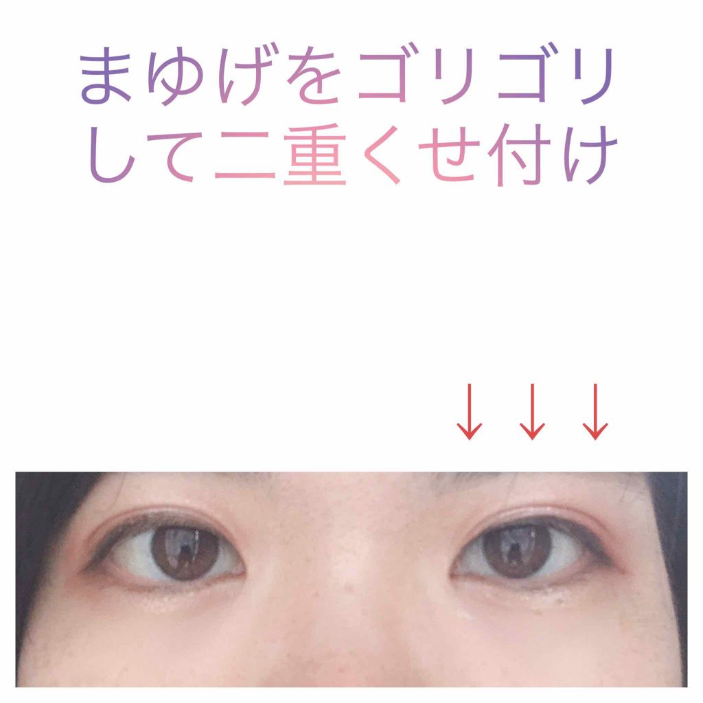 アイビューティー フィクサー WP/アストレア ヴィルゴ/二重まぶた用アイテムを使ったクチコミ(1枚目)