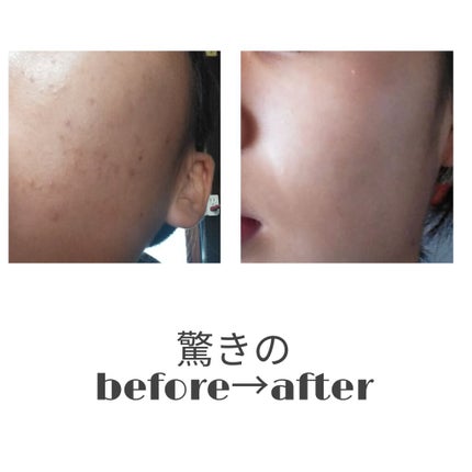 敏感肌用薬用美白美容液/無印良品/美容液を使ったクチコミ(2枚目)