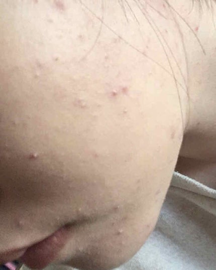 スポッツカバー ファウンデイション/SHISEIDO/クリームコンシーラーを使ったクチコミ(2枚目)