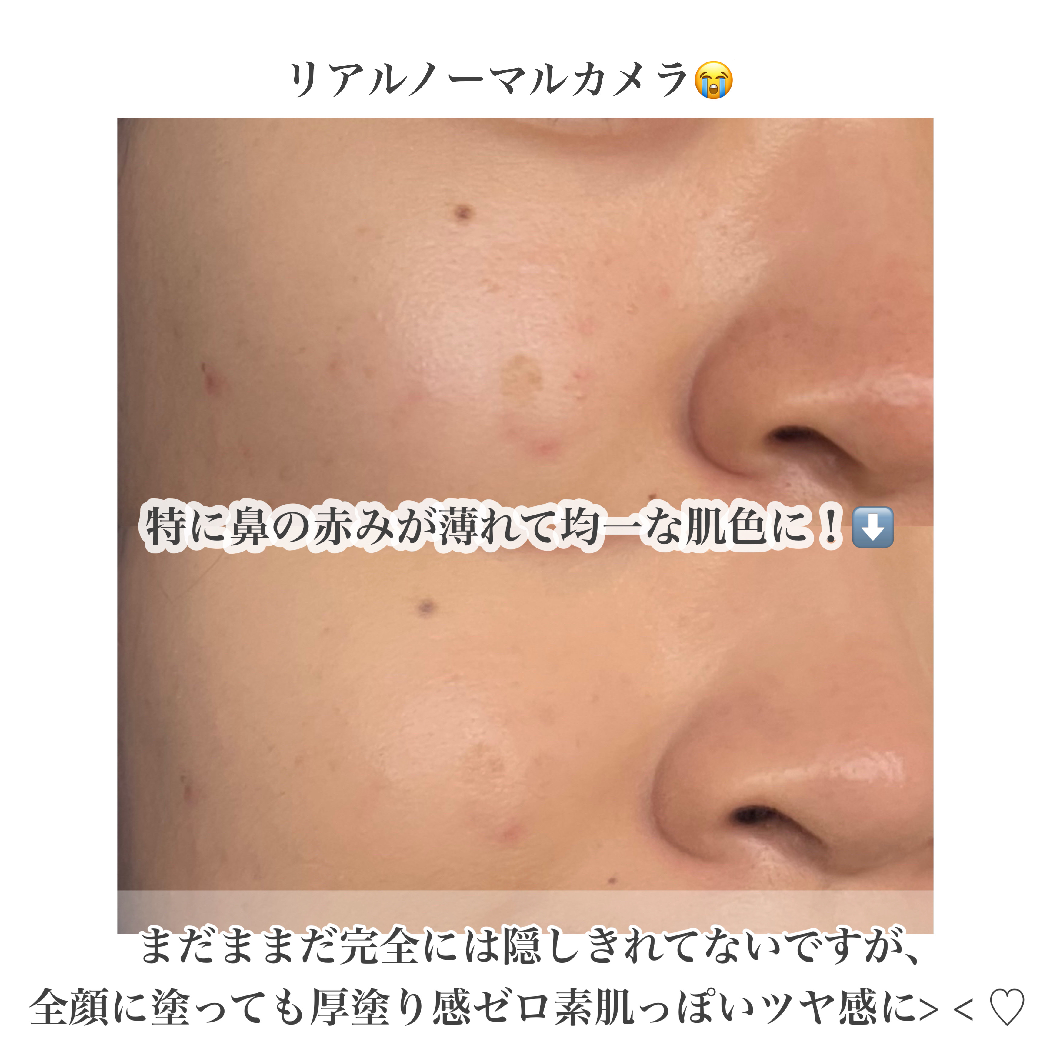 ピンクティーツリーカバーアップグロウクッション/APLIN/クッションファンデーションを使ったクチコミ（3枚目）