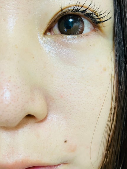 AHA·BHA·PHA 30デイズミラクルトナー/SOME BY MI/化粧水を使ったクチコミ(2枚目)