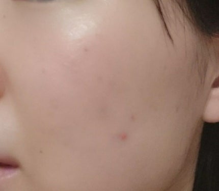 プロポリス エネルギーアンプル/CNP Laboratory/美容液を使ったクチコミ(2枚目)