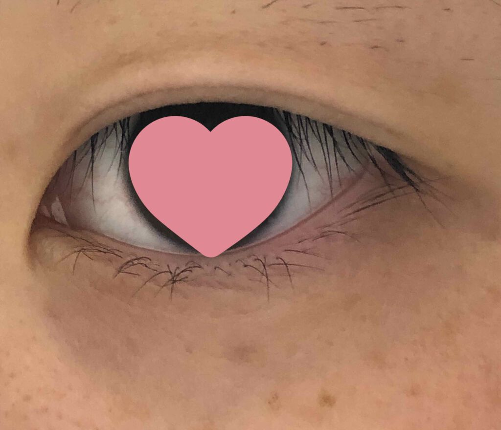 アイビューティー フィクサー WP/アストレア ヴィルゴ/二重まぶた用アイテムを使ったクチコミ（2枚目）