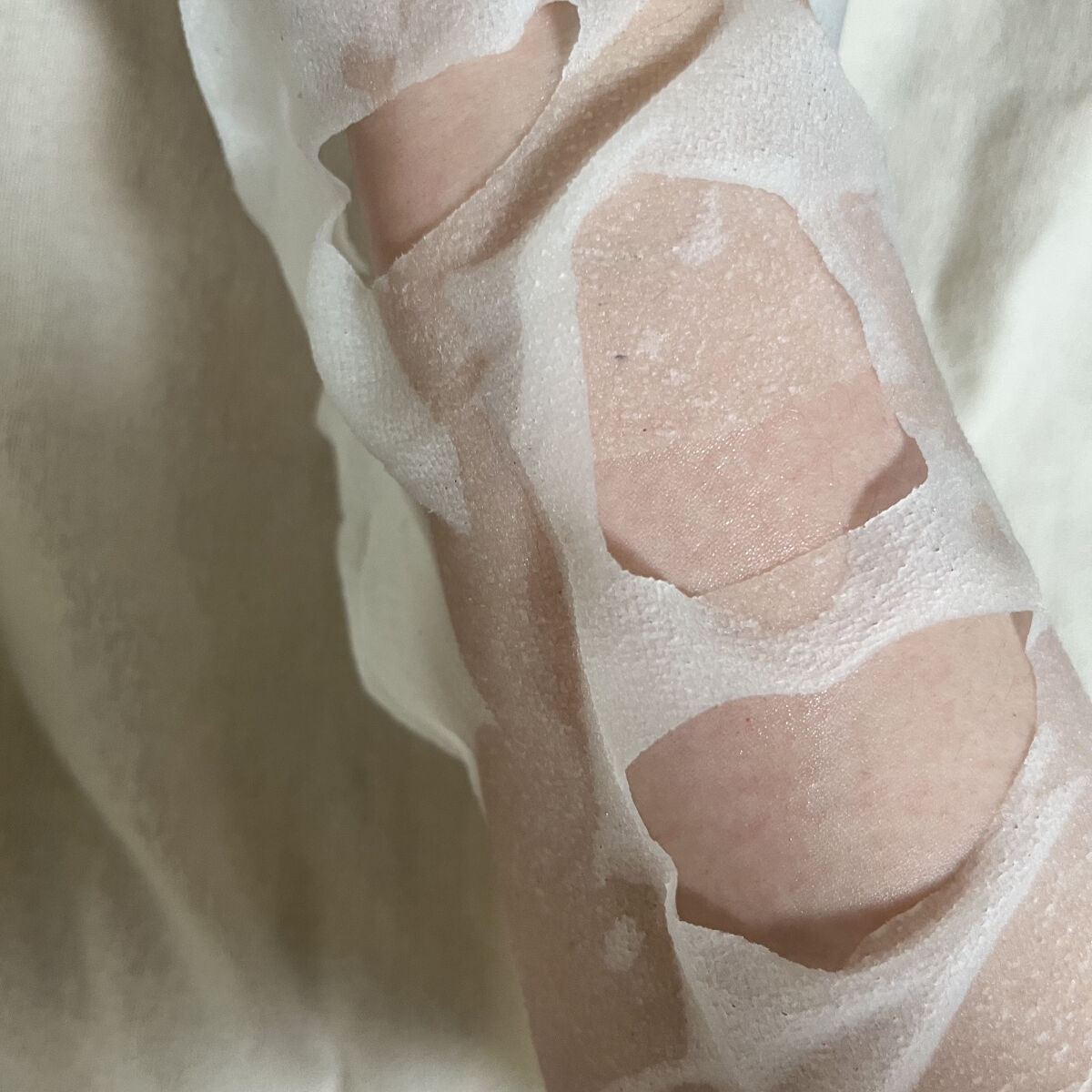 ダーマレーザー スーパーTEATREE100マスク/クオリティファースト/シートマスク・パックを使ったクチコミ（2枚目）