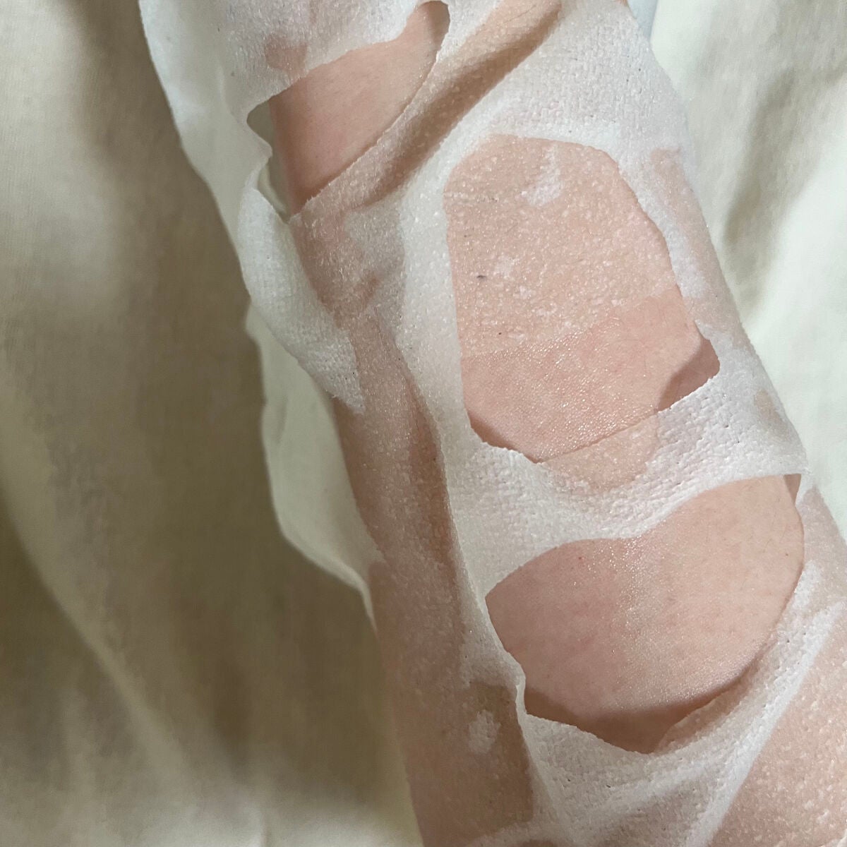 ダーマレーザー スーパーTEATREE100マスク/クオリティファースト/シートマスク・パックを使ったクチコミ(2枚目)