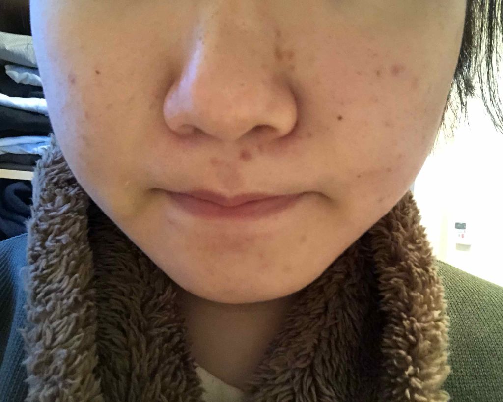 お米のマスク/毛穴撫子/シートマスク・パックを使ったクチコミ（3枚目）