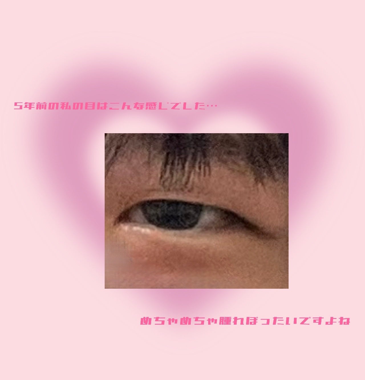 ETERNITY LINE α+/Girl's Maker/二重まぶた用アイテムを使ったクチコミ(2枚目)