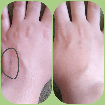 エニークッション オールデイパーフェクト/ETUDE/クッションファンデーションを使ったクチコミ(2枚目)