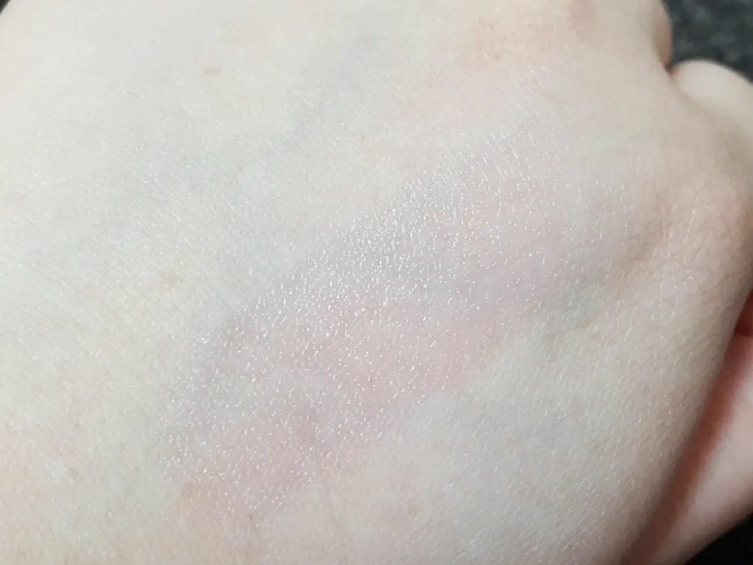 ティントリップレスキュー/FRESHO2/リップバームを使ったクチコミ(8枚目)