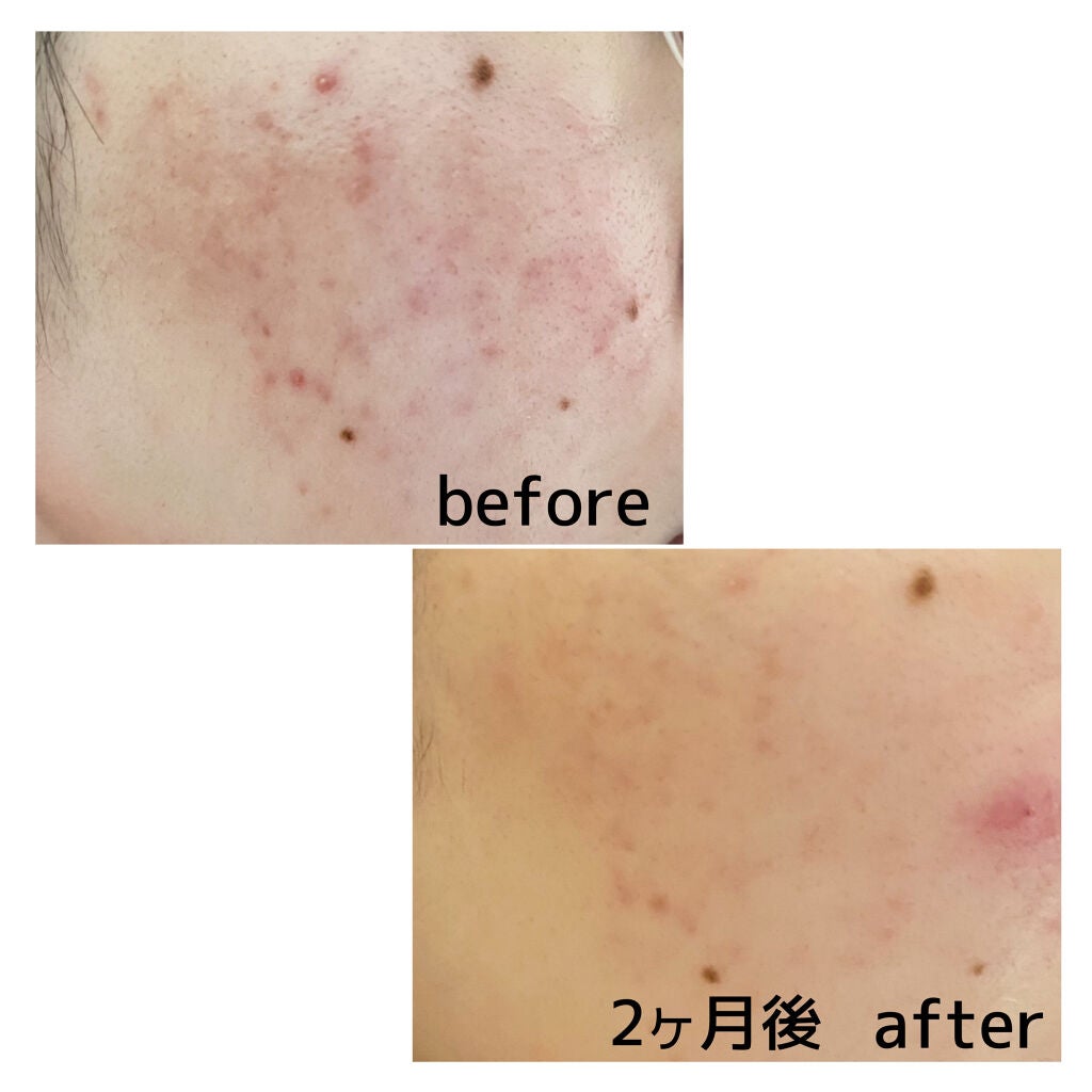 ピュアショット ナイト リチャージセラム/YVES SAINT LAURENT BEAUTE/美容液を使ったクチコミ(2枚目)