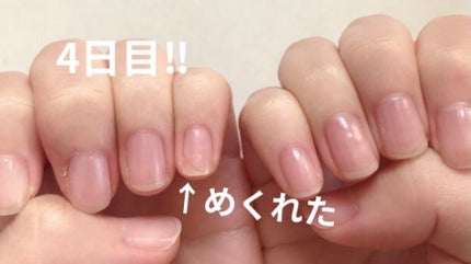 インフィニット シャイン リッジフィラー ベースコート/O・P・I/ネイルベースコートを使ったクチコミ(4枚目)