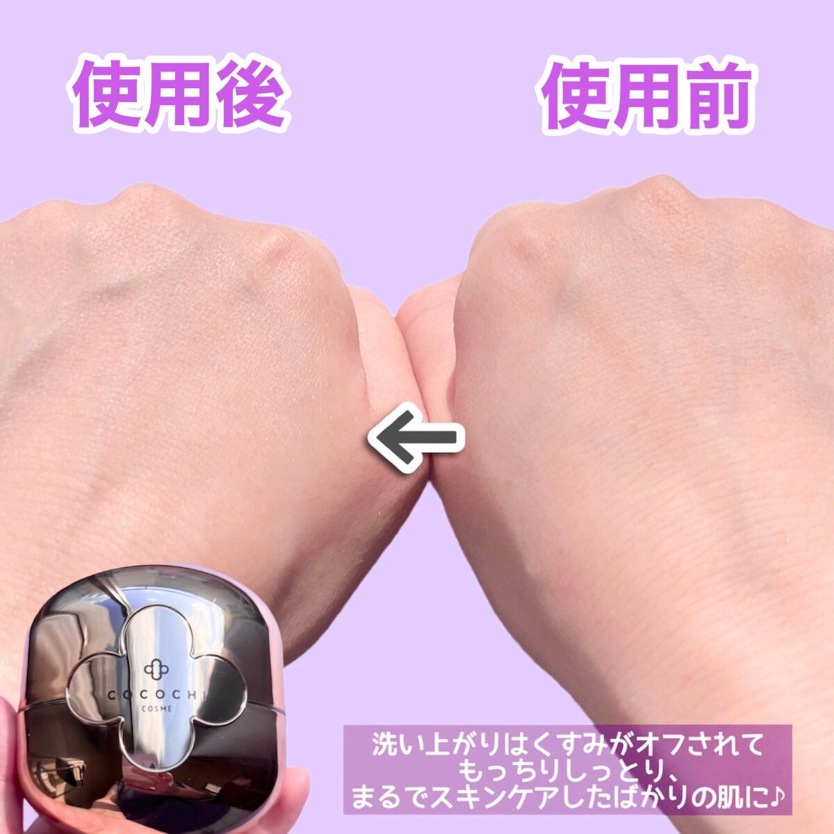 AG アルティメット フェイシャルクリームマスク/AGアルティメット/フェイスクリームを使ったクチコミ(6枚目)