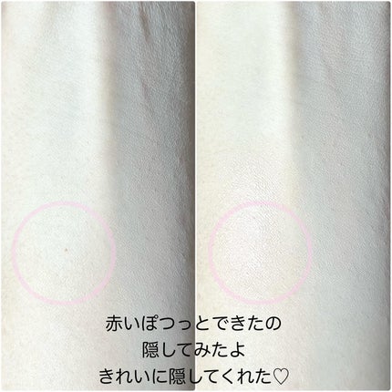 ダーマシンコンシーラー/23years old/リキッドコンシーラーを使ったクチコミ(7枚目)