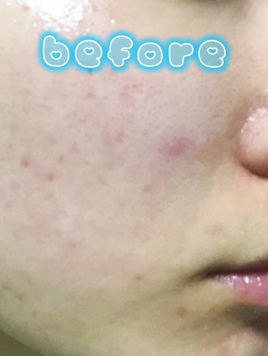 アスタリフトBBクリーム/アスタリフト/BBクリームを使ったクチコミ(3枚目)