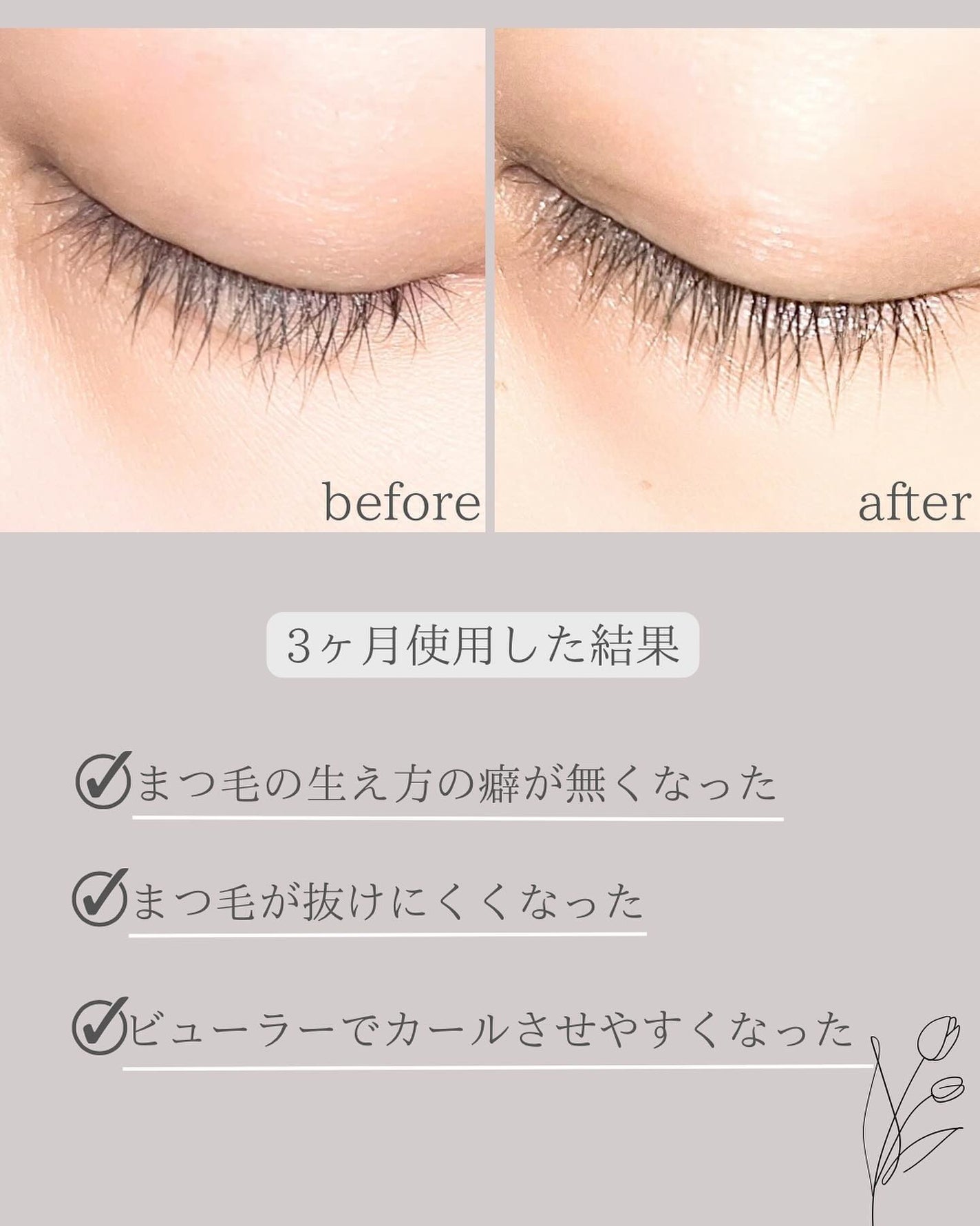 MAアイラッシュセラム|MATSUGE OMOIの口コミ - 敏感肌に MAアイラッシュセラム|MATSUGE OMOIの口コミ - 敏感肌に