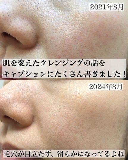 クレンジングミルク/chant a charm /ミルククレンジングを使ったクチコミ(4枚目)