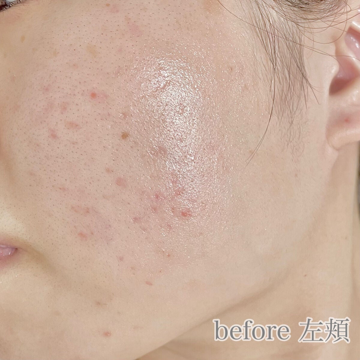 ピュア ナチュラル エッセンスローション リフト /pdc/オールインワン化粧品を使ったクチコミ(3枚目)