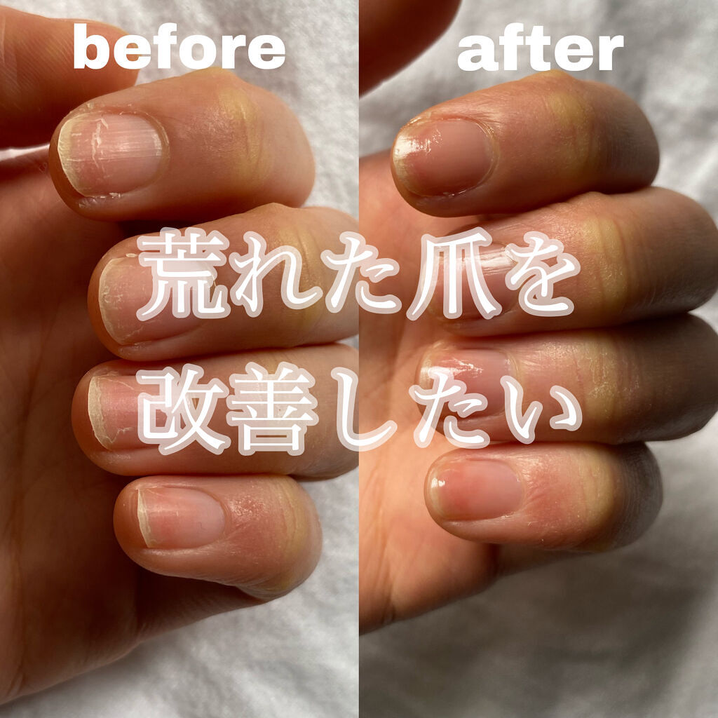 自爪補強コート/デュカート/ネイルベースコートを使ったクチコミ（1枚目）