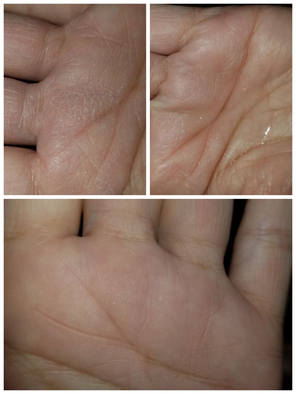 ロゼベ プラセンタモイスチュアローション (さっぱり)/ROZEBE/化粧水を使ったクチコミ（2枚目）