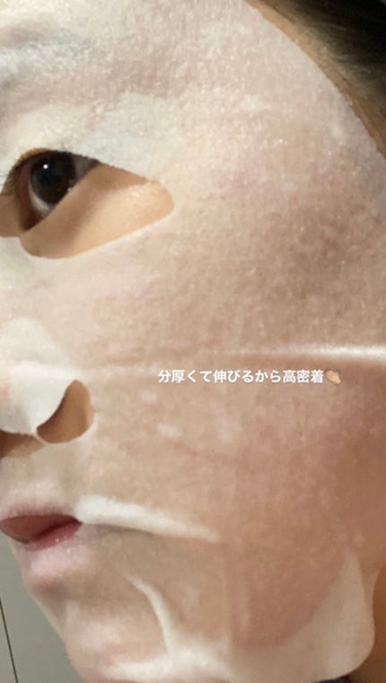 ルルルン ハイドラ V マスク/ルルルン/シートマスク・パックを使ったクチコミ(2枚目)