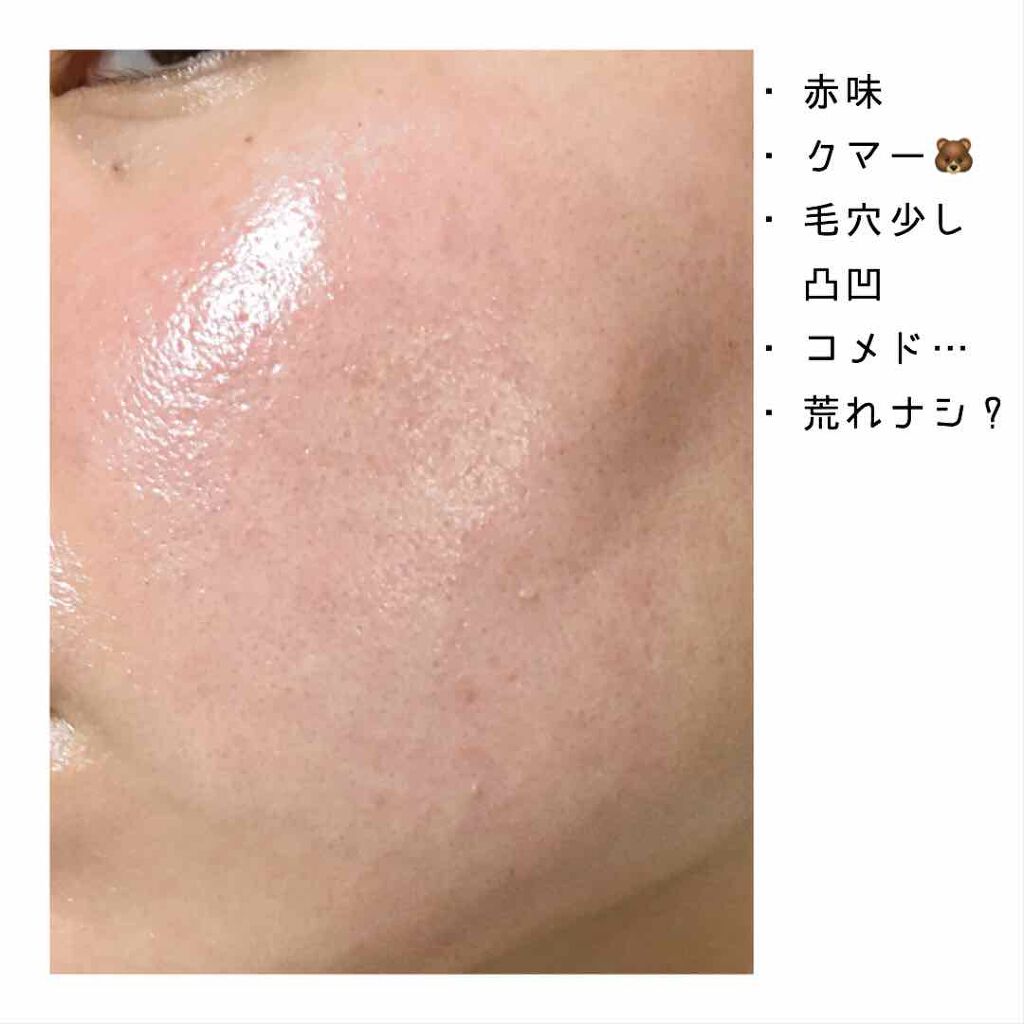 イハダ 薬用バーム【医薬部外品】/IHADA/フェイスバームを使ったクチコミ（3枚目）