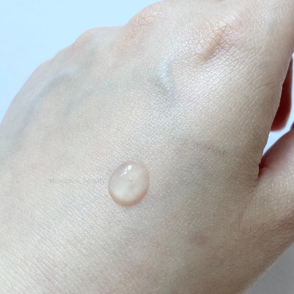 アクニドクターファーストスピーディースポット/ISOI/美容液を使ったクチコミ(4枚目)