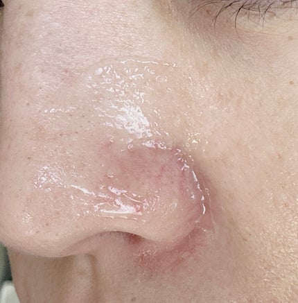 ビタバランスジェルクレンジング/.akaran/クレンジングジェルを使ったクチコミ(5枚目)