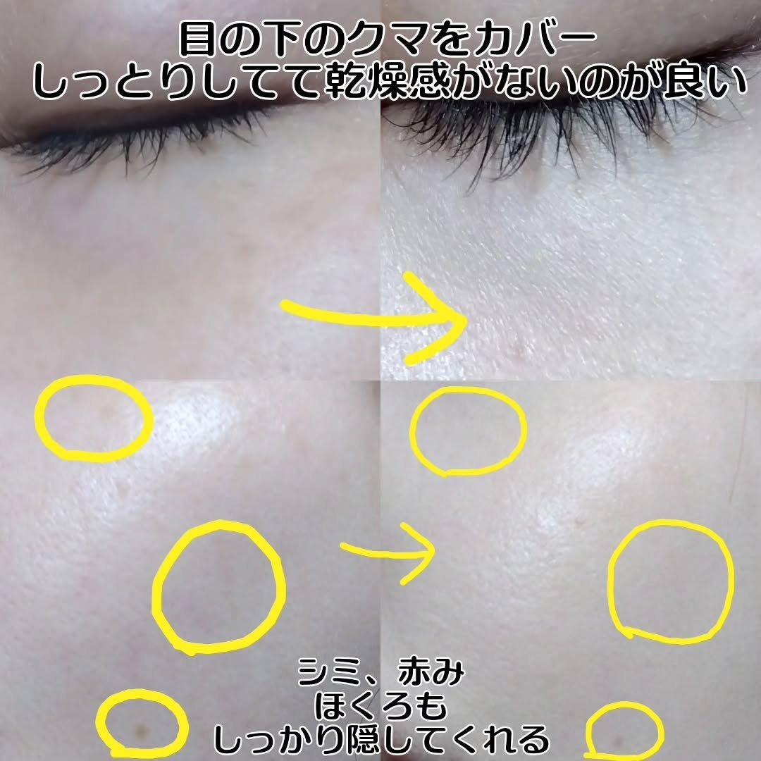 ダーマシンコンシーラー/23years old/リキッドコンシーラーを使ったクチコミ(5枚目)