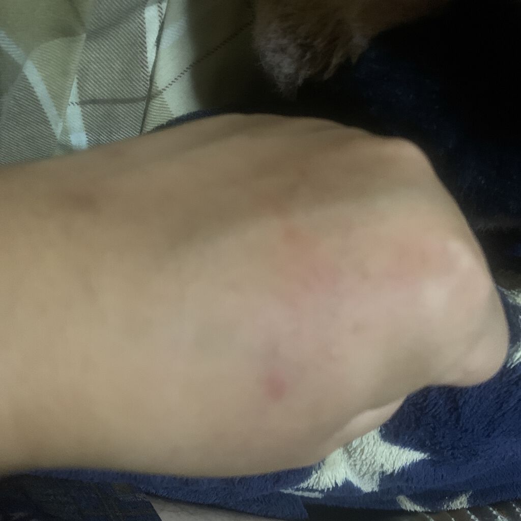 ルージュ ピュールクチュール ヴェルニ/YVES SAINT LAURENT BEAUTE/口紅を使ったクチコミ（3枚目）