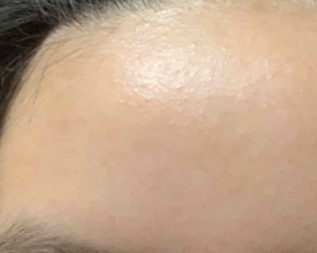 ハトムギ化粧水(ナチュリエ スキンコンディショナー R )/ナチュリエ/化粧水を使ったクチコミ（3枚目）