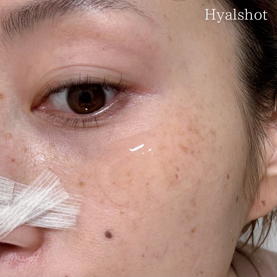 RTXセラム ビタミンショット/Dr.G/美容液を使ったクチコミ(5枚目)