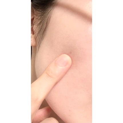 スマートアクティベーター/SISI/美容液を使ったクチコミ(3枚目)