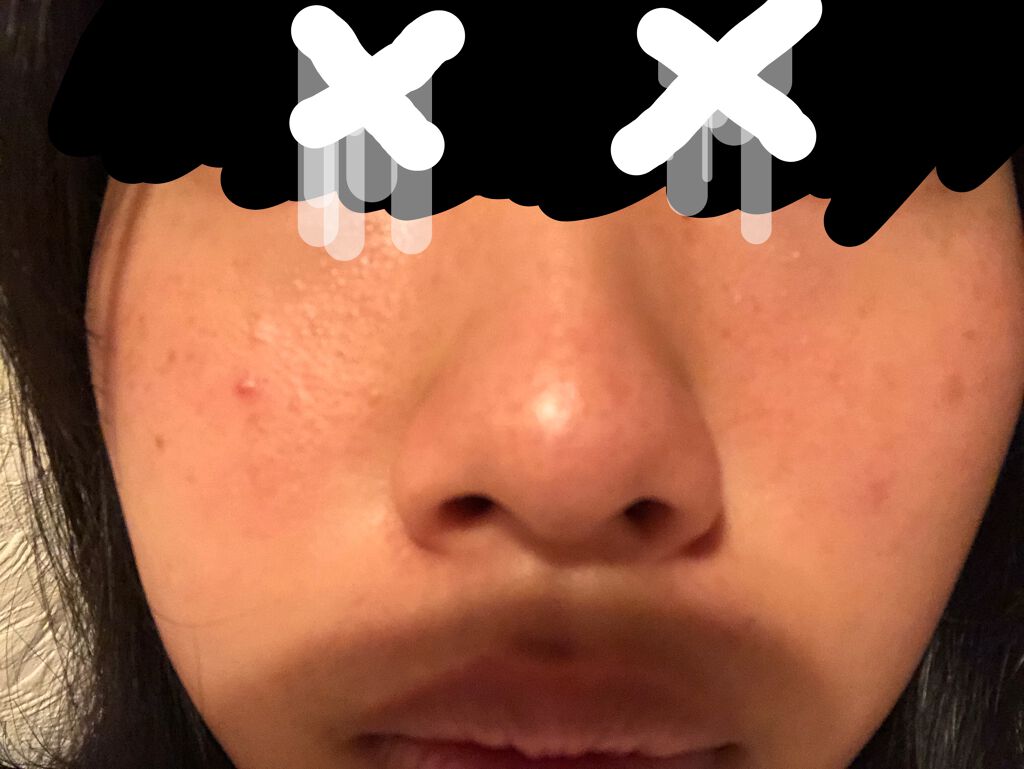 艶肌ドロップ/ラッシュ/美容液を使ったクチコミ（3枚目）