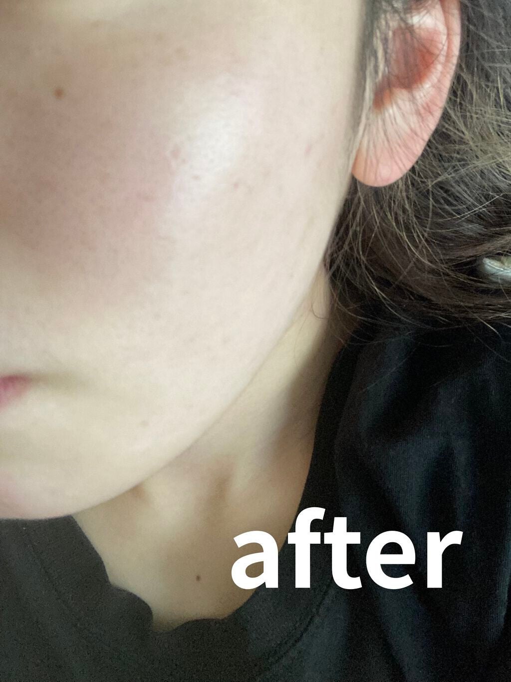 薬用ローション(とてもしっとり)/IHADA/化粧水を使ったクチコミ(3枚目)