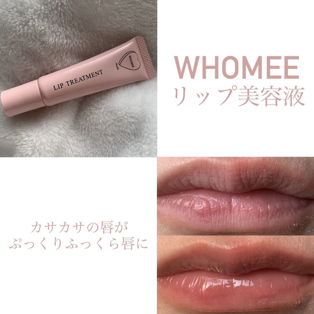 リップ美容液/WHOMEE/リップ美容液を使ったクチコミ（1枚目）