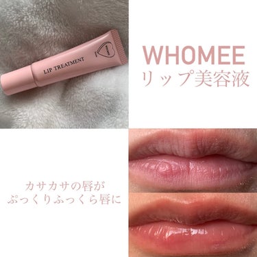 リップ美容液/WHOMEE/リップケア・リップクリームを使ったクチコミ（1枚目）