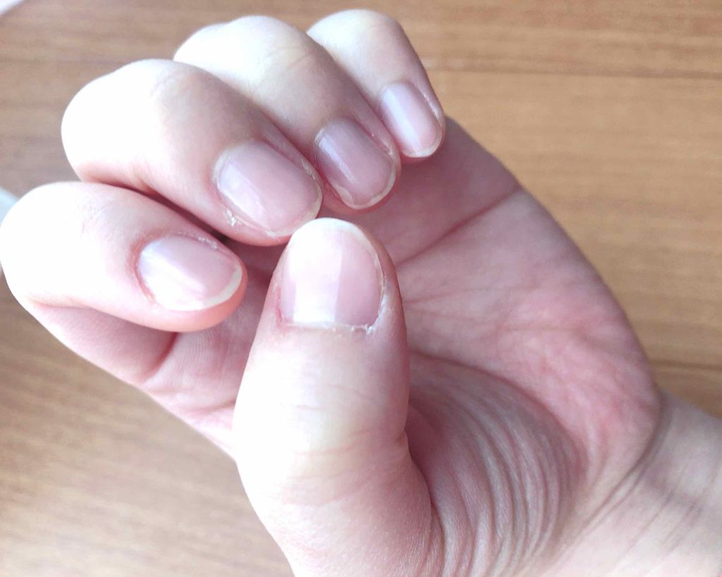 エテュセ クイックケアコート/ettusais/ネイルオイル・トリートメントを使ったクチコミ（2枚目）