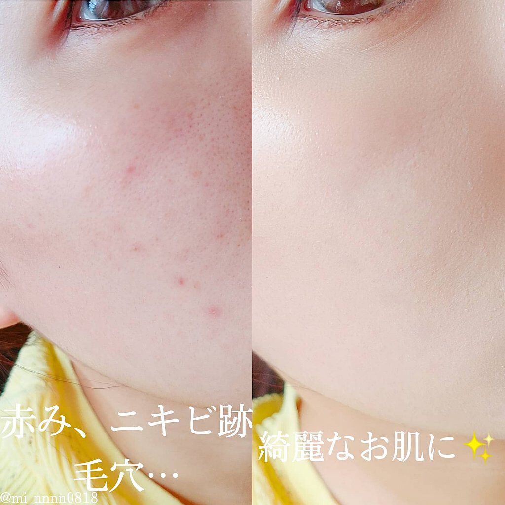 エアクッション カバー/IOPE/クッションファンデーションを使ったクチコミ(2枚目)