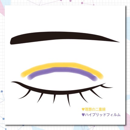 ハイブリッドフィルム/アイトーク/二重まぶた用アイテムを使ったクチコミ(2枚目)