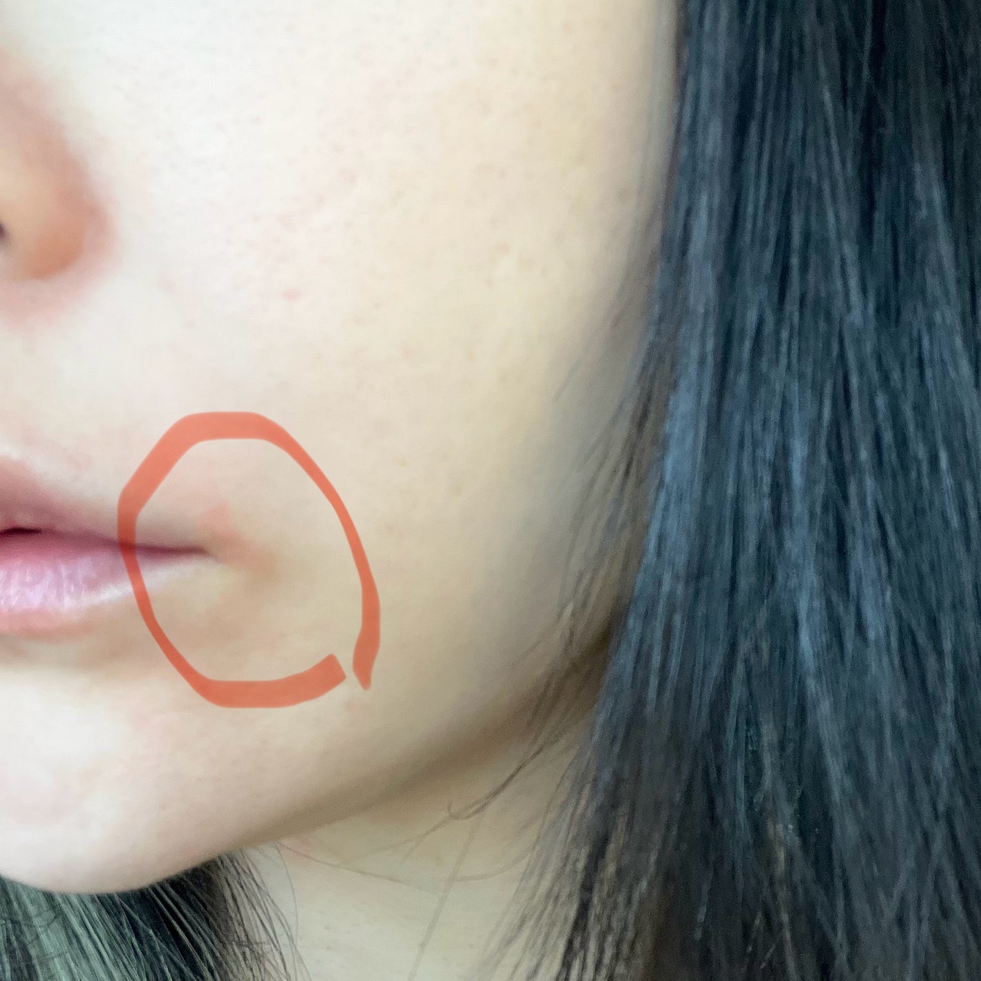 プリスクリードD(医薬品)/IHADA/その他を使ったクチコミ(2枚目)