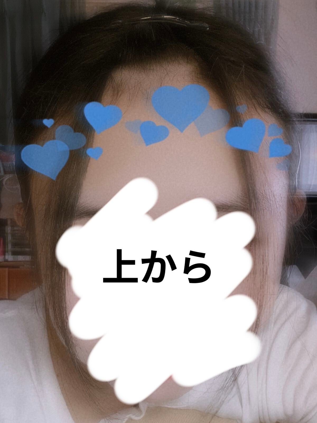 ヘアアクセルレーターEX フローラルアップルの香り/加美乃素本舗/頭皮ローションを使ったクチコミ(5枚目)