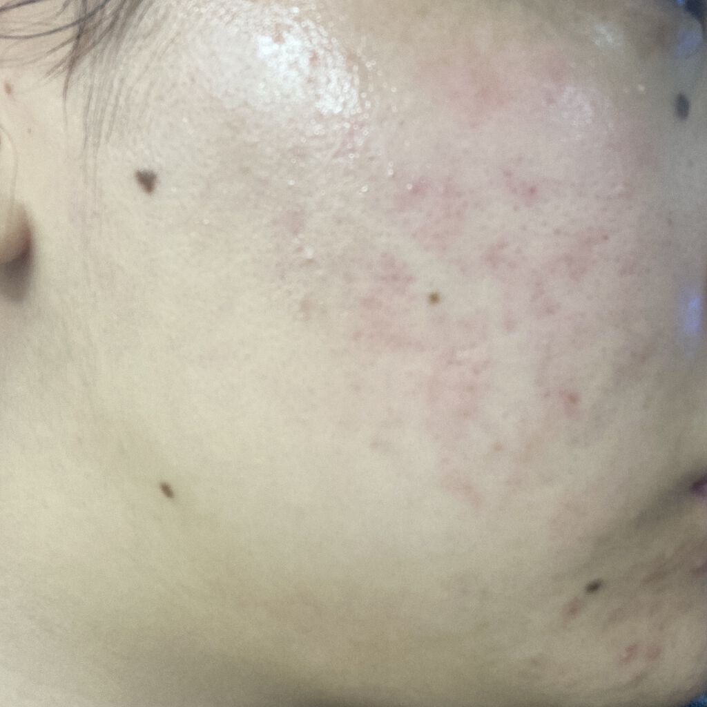 を使ったクチコミ（2枚目）