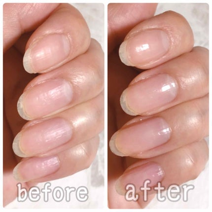 ディーアップファンデーション/D-UP/ネイルベースコートを使ったクチコミ(3枚目)