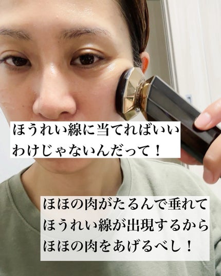 RF温冷美顔器PRO/ANLAN/美顔器・マッサージを使ったクチコミ(6枚目)