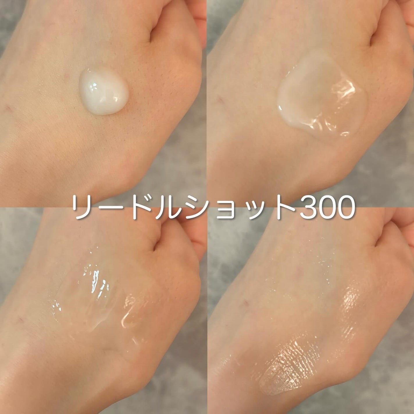 シカレチA エッセンス0.1/VT/美容液を使ったクチコミ(4枚目)