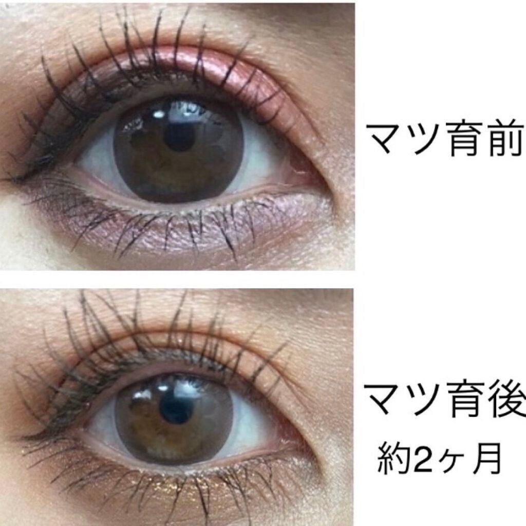 エグータム/アルマダスタイル/まつげ美容液を使ったクチコミ(6枚目)