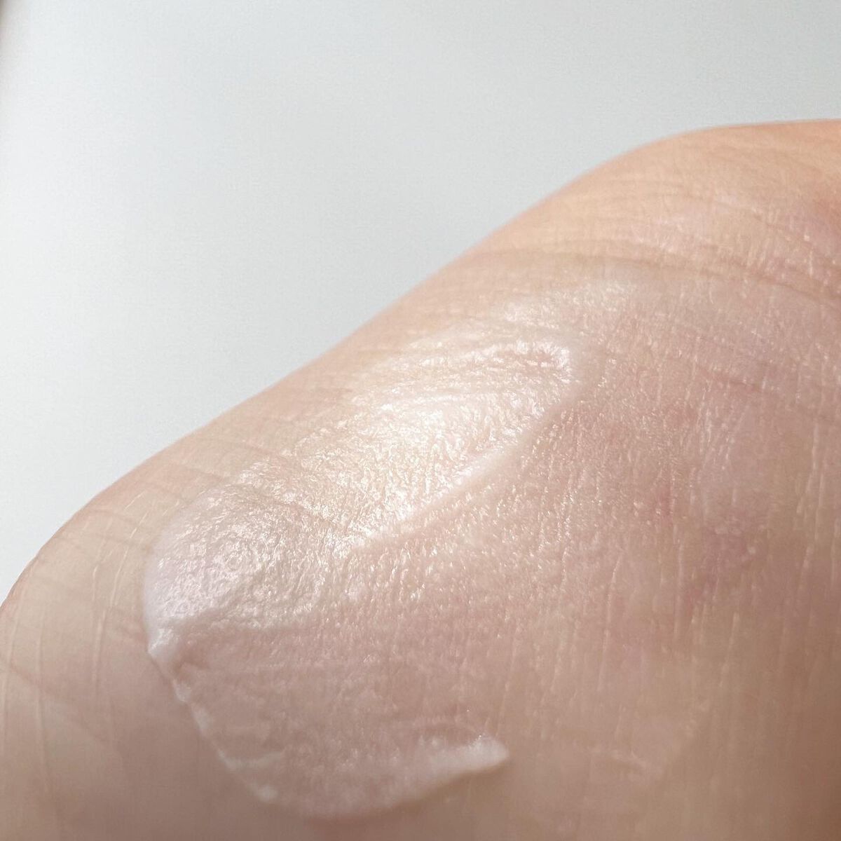 CICAケアバーム/ロベクチン/フェイスクリームを使ったクチコミ(3枚目)