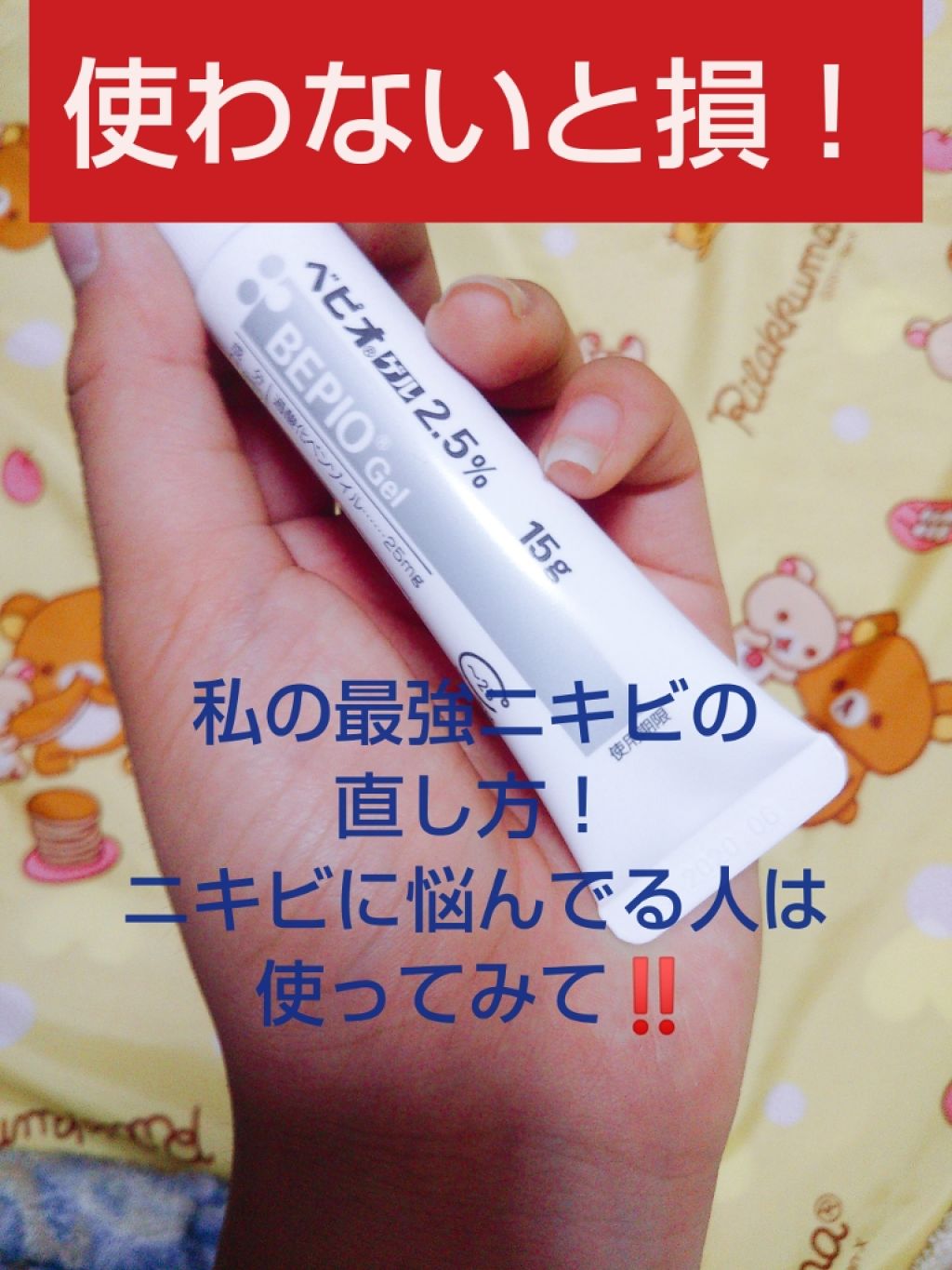 ベピオゲル/マルホ株式会社/その他を使ったクチコミ（1枚目）