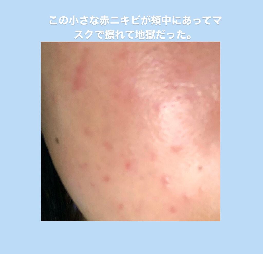 マデカソ CICAクリーム  /A’pieu/フェイスクリームを使ったクチコミ(2枚目)