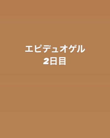 エピデュオゲル/マルホ株式会社/その他を使ったクチコミ（1枚目）